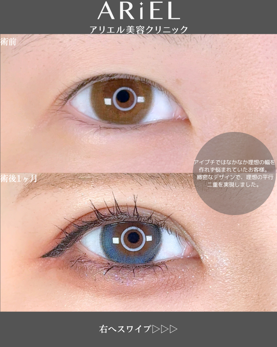 No.9102の症例写真